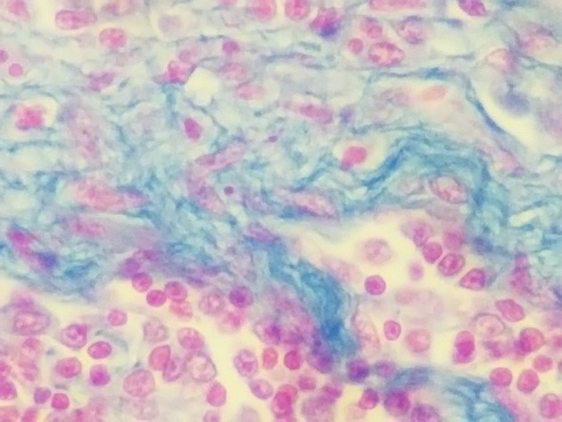 Reticular Connective Slides - Reticular Connective 03 400X